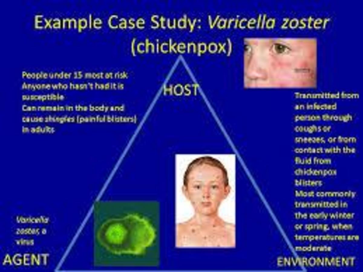 Varicella zoster. Вирус varicella zoster эпидемиология. Тропность Варицелла зостер. Варицелла зостер как выглядит.