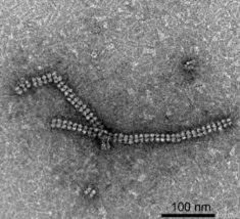Transmission Electron Microscopy (TEM) image of the protein nanotubes. Credit: Chemical Science