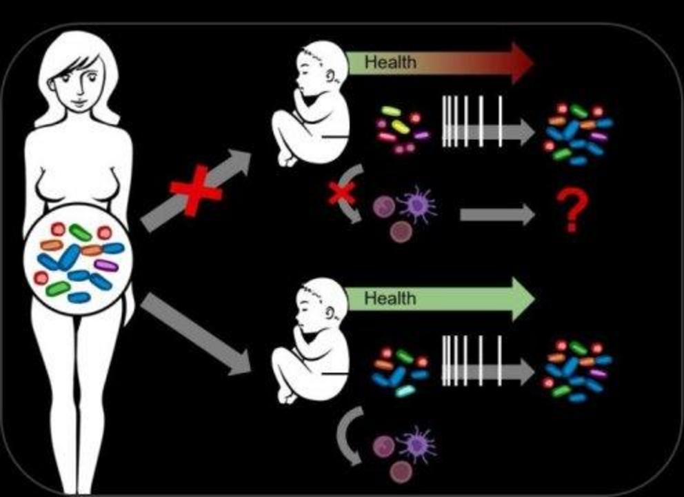 Caesarean birth prevents important bacterial functions from being passed on. This change impacts immune stimulations during the first days of life and may explain why caesarean-born children suffer more frequently from chronic immune disorders.