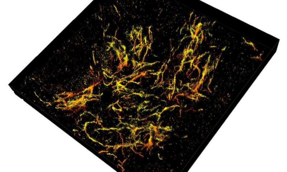 Purdue researchers have taken 3D single molecule super-resolution images of the amyloid plaques associated with Alzheimer's disease in 30-micron thick sections of the mouse's frontal cortex.