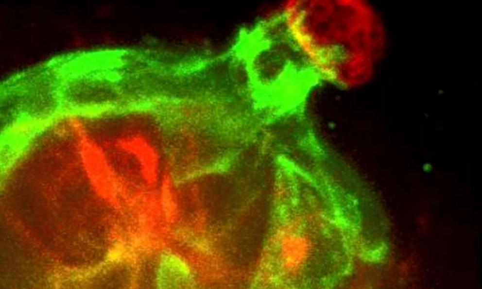 Real-time 3D confocal time-lapse movie of Twist1-expressing epithelial cells (red) invading into the surrounding extracellular matrix and then being restrained and pulled back by normal myoepithelial cells (green).