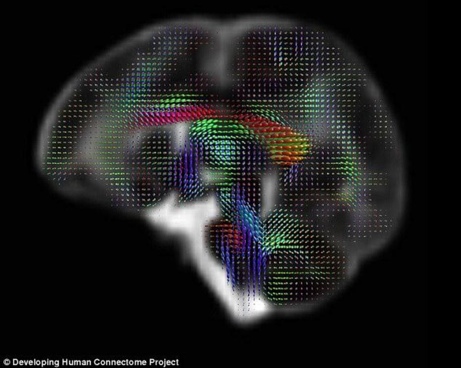 Overall, the researchers hope they will soon be able to create a dynamic map of brain connectivity from 20 to 44 weeks post-conception, which will link together imaging, clinical, behavioural, and genetic information