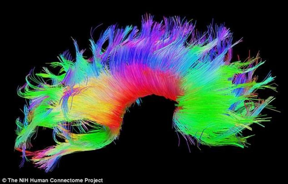 Known as a 'functional fingerprint', it could help identify people, and also unlock the mystery of diseases such as ADHD and autism. Pictured, a 'brain map' image similar to those used in the study.