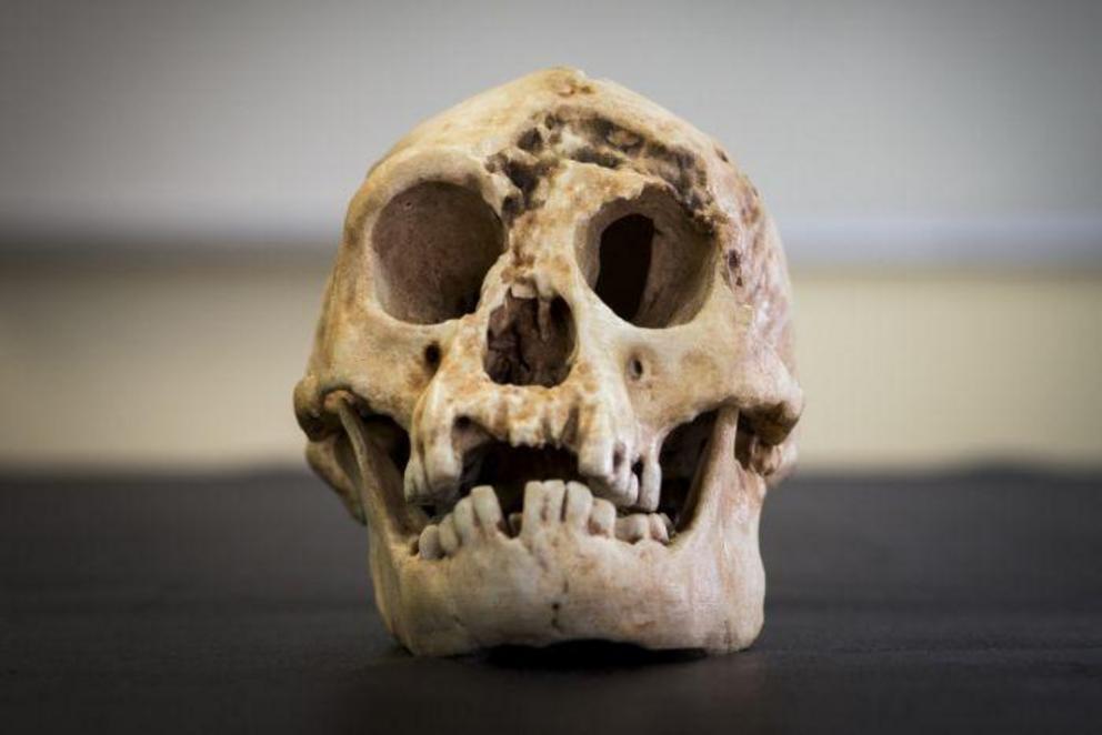 Homo floresiensis had a tiny head, holding a brain that was around a third the volume of ours.