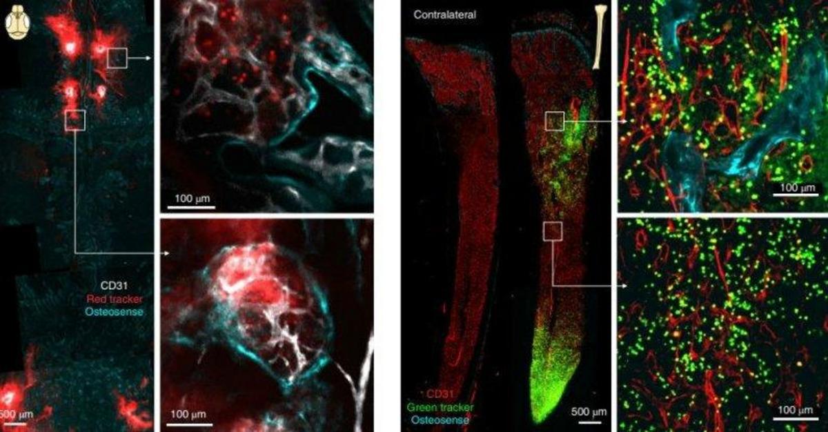 Science alert. Существуют "секретные" туннели, соединяющие ваш череп и мозг. Nature Neuroscience.