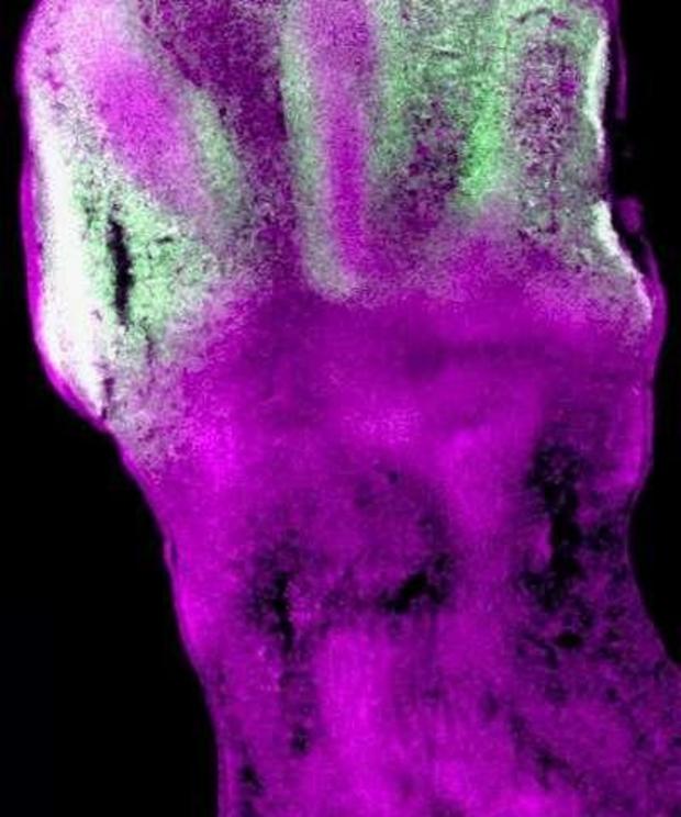 The reconstructed 20X image above (from 54 adjacent photos) represents a section through a developing mouse embryonic arm and hand. All cells are stained in magenta superimposed with a green signal in the cells expressing the mRNA of Hoxd13 gene, one of t