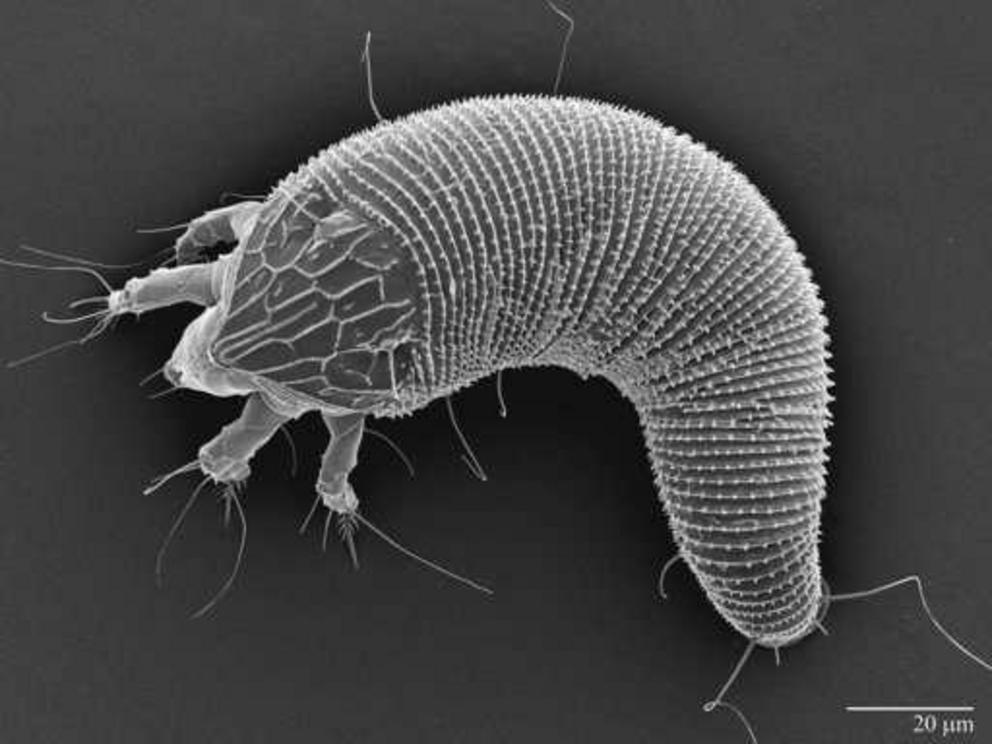 In this scanning electron microscopy image, provided by the U.S. Department of Agriculture's Agriculture Research Service, the tiny mite that carries the virus for rose rosette disease is pictured in a black and white photo dated Oct. 16, 2016. The mite i