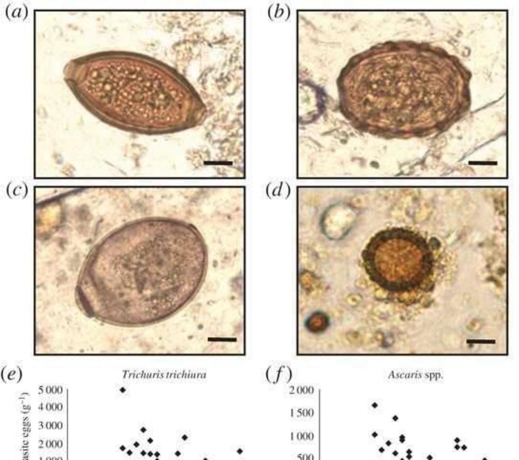 Яйцо паразита. Trichuris SPP 0-2 В поле зрения это много?.