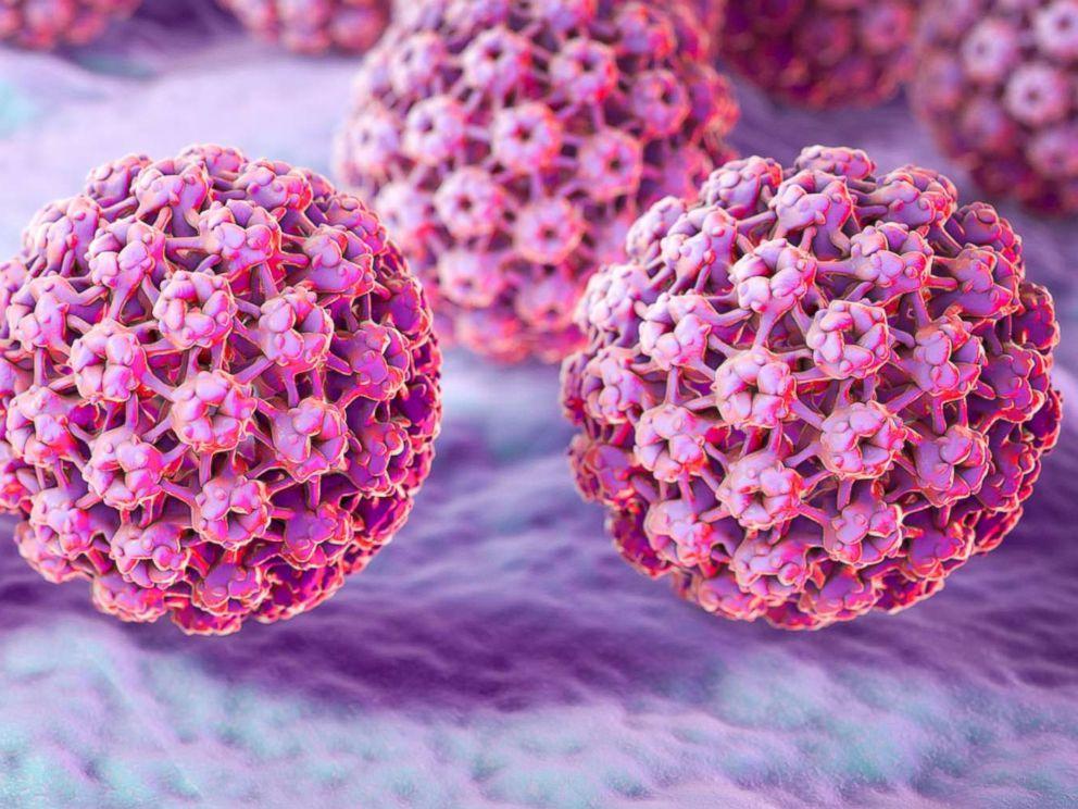 (Kateryna Kon/Science Photo Library via Getty Images)  A computer illustration of human papilloma virus (HPV) is pictured in this undated photo.