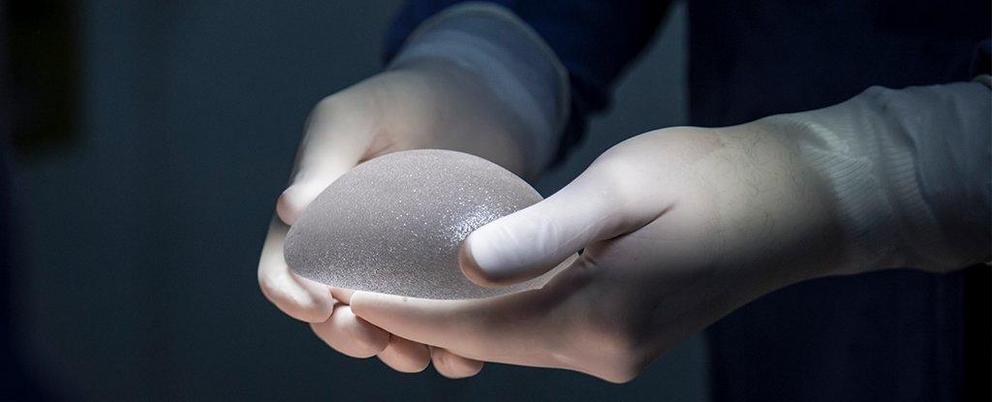 Breast Implants Have Been Linked To A Rare Cancer In Even More Cases Nexus Newsfeed