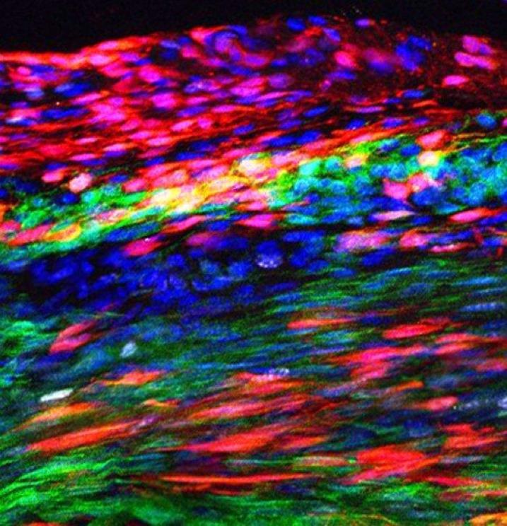 Red marks are newly discovered tendon stem cells that have self-renewed in the Patellar tendon after injury.