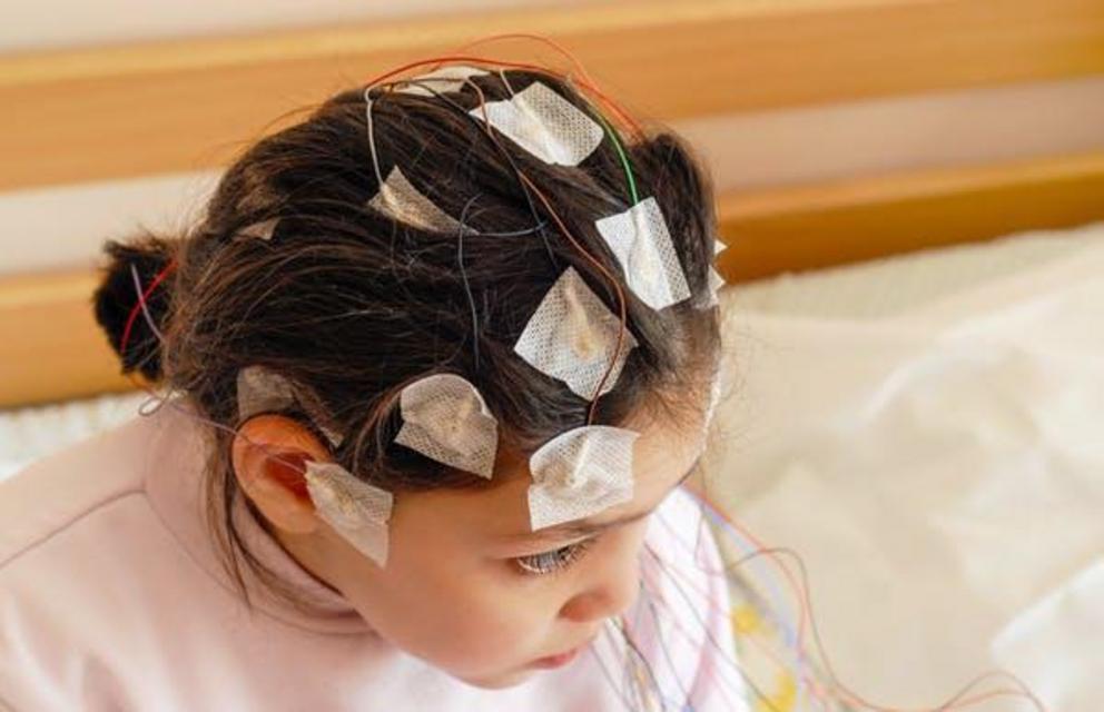 External electrodes can record a brain’s activity.