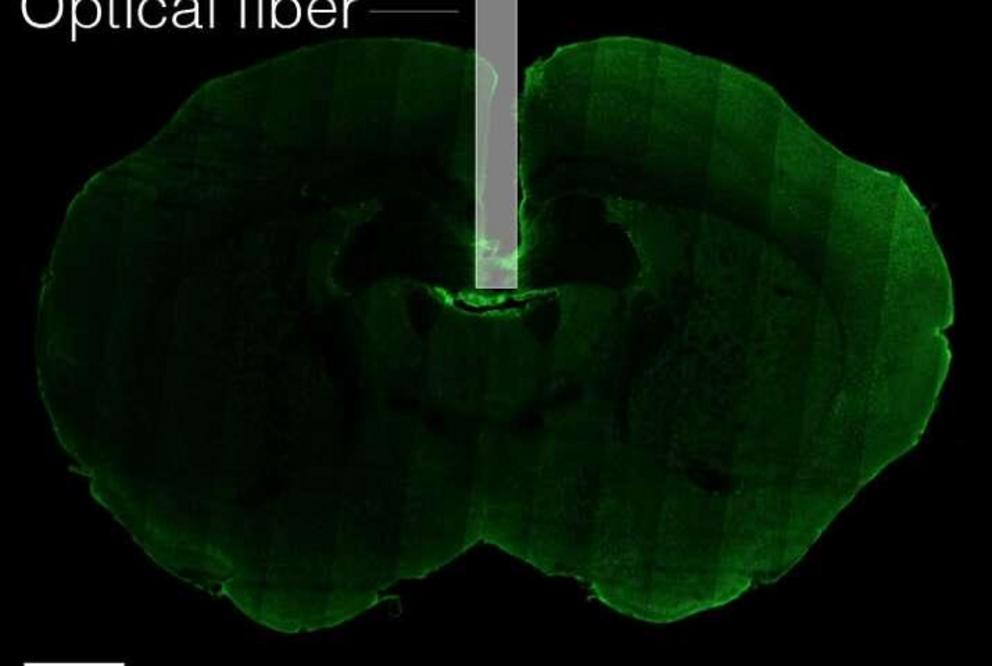 An optical fiber (gray bar) threaded into the brain of a mouse (green) revealed activity of neurons involved in thirst. Scale bar equals 1 millimeter.