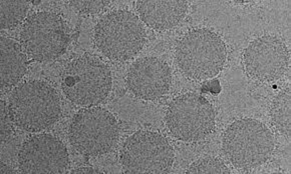 1 / 1 Transmission electron microscopy image showing the formation of biomolecular corona around the surface of nanoparticles. Credit: Morteza Mahmoudi, Brigham and Women's Hospital
