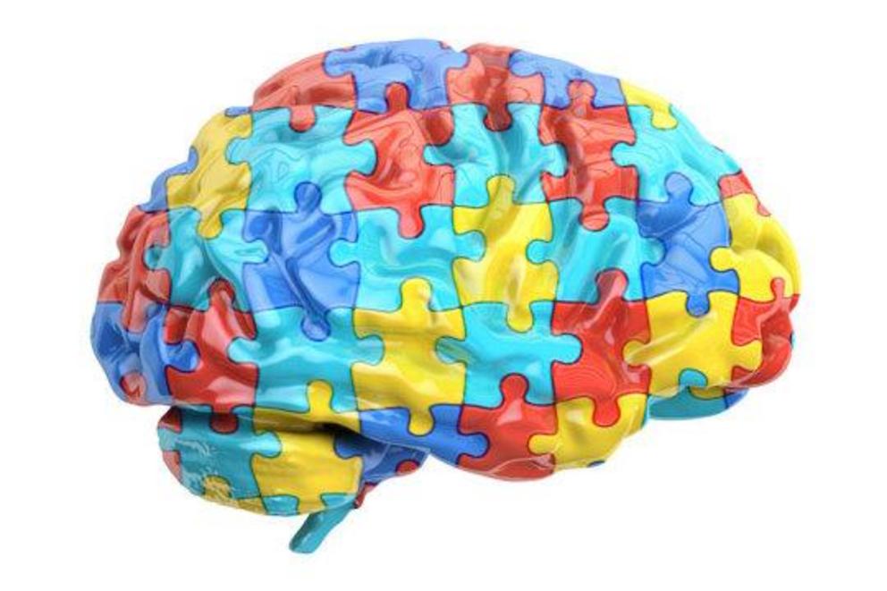 Autism/puzzle brain abstract concept (stock image).  Credit: © alexlmx / Adobe Stock