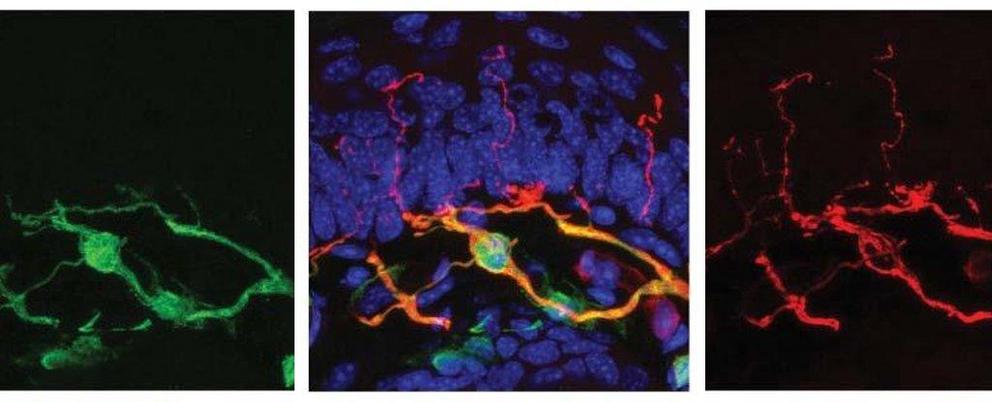 Pain-detecting Schwann cells in mouse skin. (Abdo et al., Science, 2019)