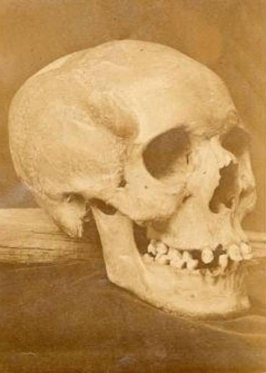 Ms Adie's skull was last known to have been exhibited in Glasgow's Bellahouston Park in 1938, but photographs of the remains that were taken at St Andrews University in 1904 remain held in the collections of the National Library of Scotland