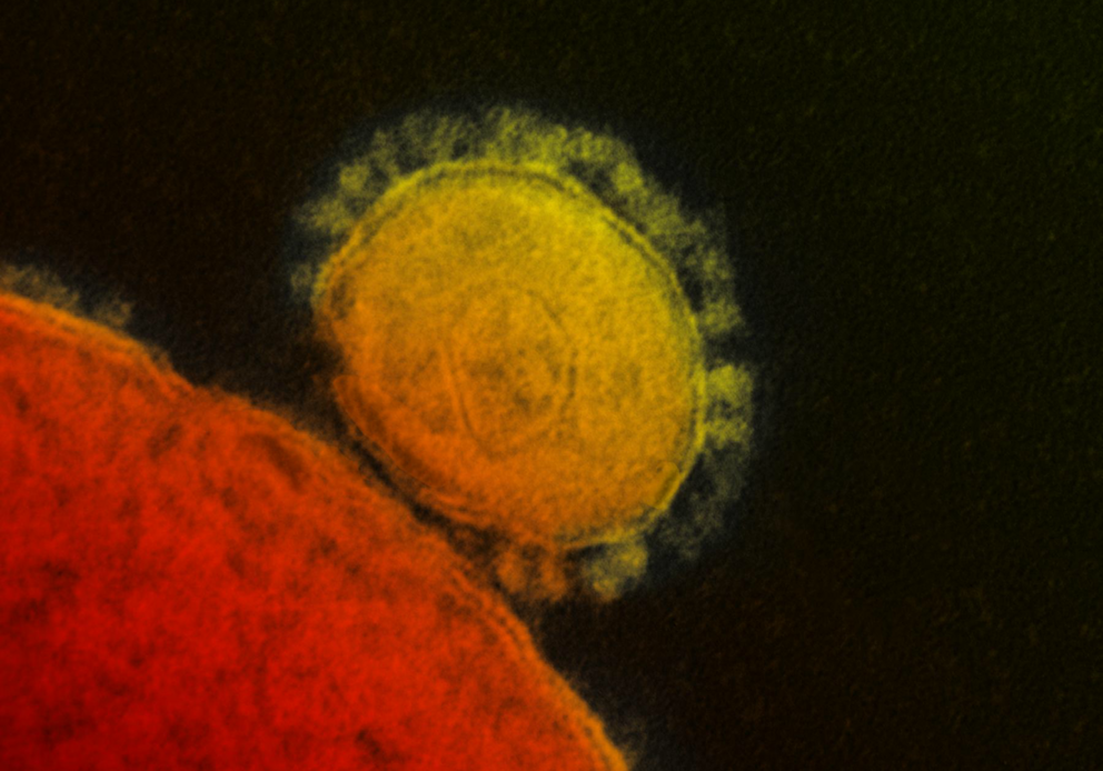 MERS coronavirus  flickr, niaid