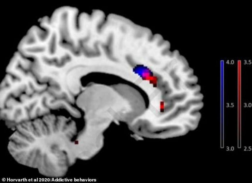  How smartphone addiction changes your BRAIN: Scans reveal how grey matter of tech addicts physically changes shape and size in a similar way to drug users      German researchers examined the brains of 48 participants using MRI images     Total of 22 peo