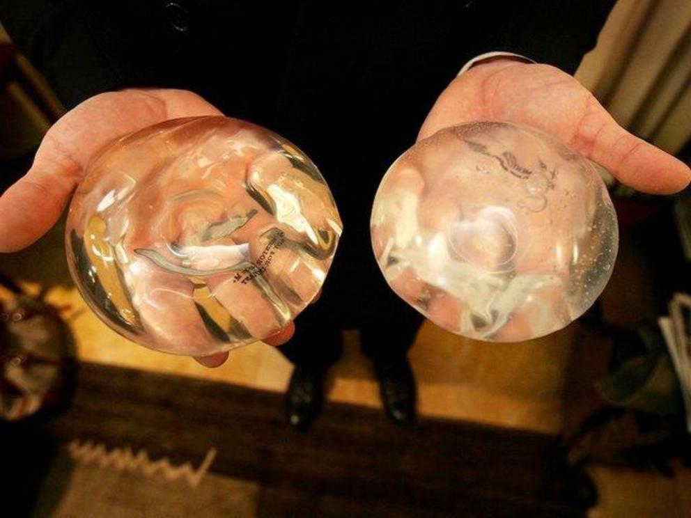 Dr. Brad Jacobs holds up a silicone implant gel (L) and a saline implant gel (R) inside of his office November 21, 2006 in New York City.