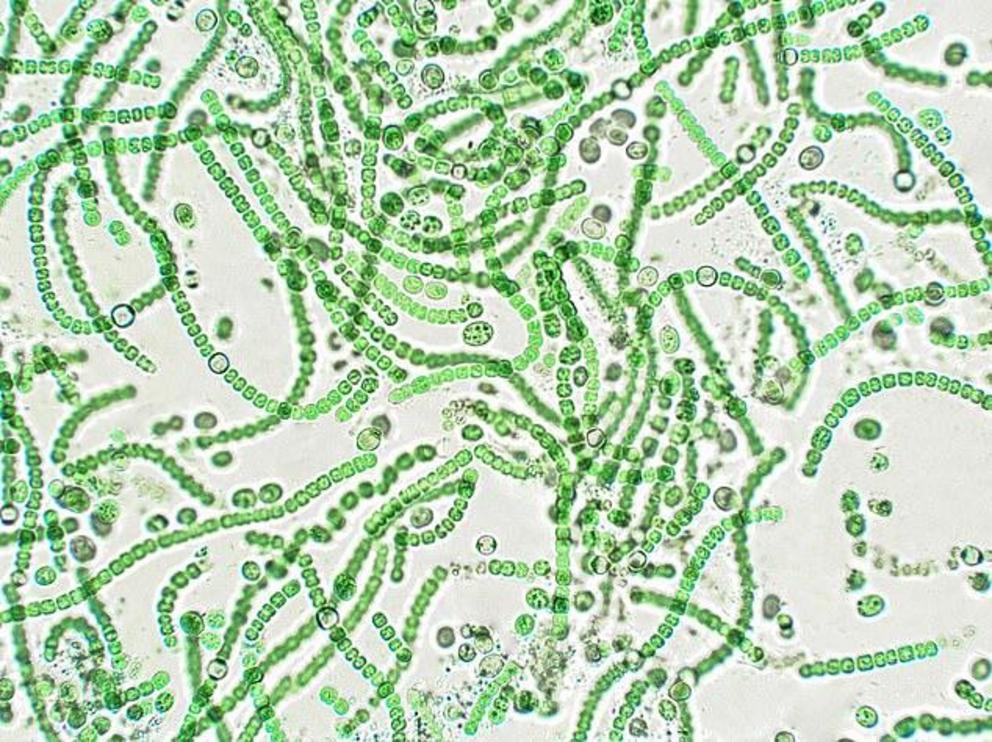 Nostoc, a genus of cyanobacteria, under microscopic view. Cyanobacteria would have inhabited the early 'waterworld' of Earth 3.2 billion years ago