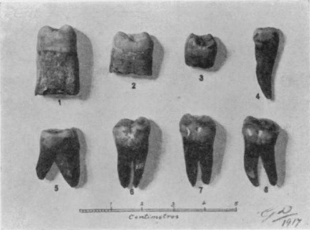 Photograph of the teeth found in 1917 suggesting evidence of Paleolithic humans in Malta.