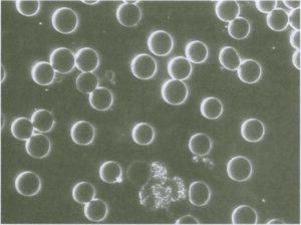 Figure 1. Top: Red blood cell clumping before EFT. Bottom: Red cells evenly distributed after 12 minutes of EFT. Source: D. Church, The Genie in Your Genes, p 235. (Originally obtained by Church in 2009 from www.emofree.com.)