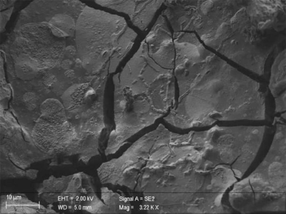 A neuron, along with its axons, is visible in this vitrified segment of brain tissue from a victim who was covered by ash when Mount Vesuvius erupted in 79 AD.