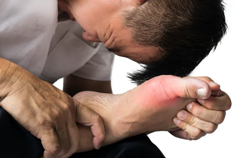 Gout can be incredibly painful.