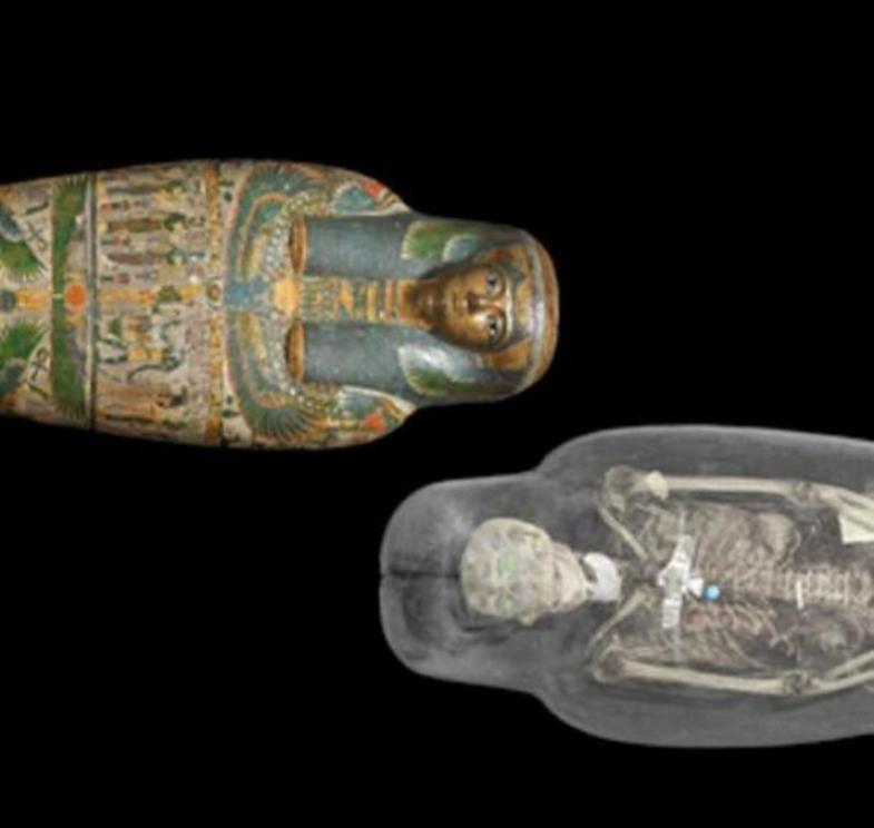 CT Scan image of mummy.