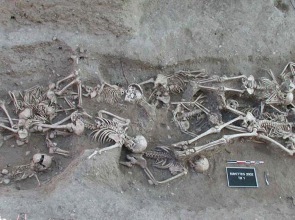 People who died of bubonic plague in a mass grave from 1720 to 1721 in Martigues, France.