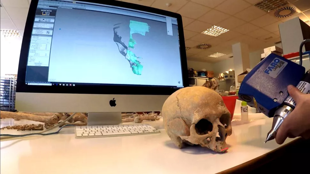 A skull is laser scanned so that it can inform a digital facial reconstruction.