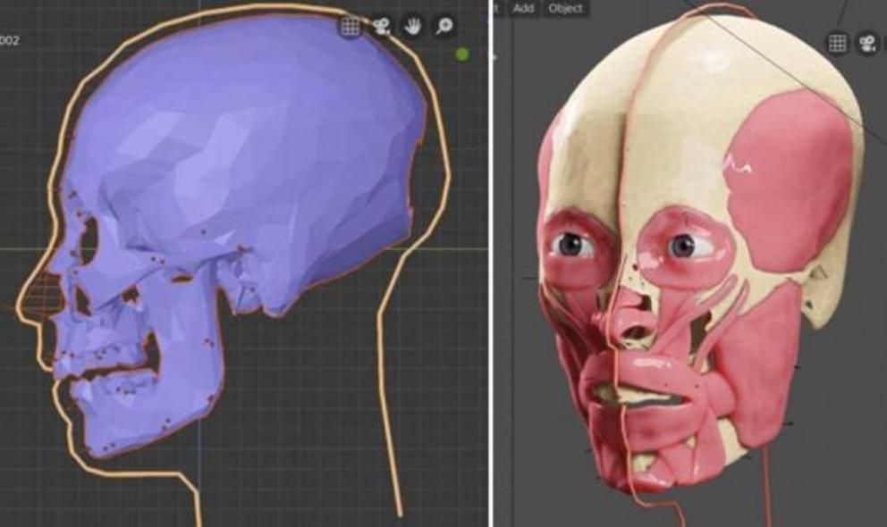Steps in the facial reconstruction process.