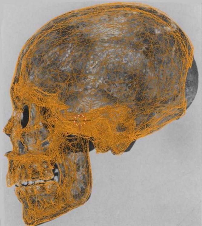 Mummy KV55’s skull with data points used in the facial reconstruction.