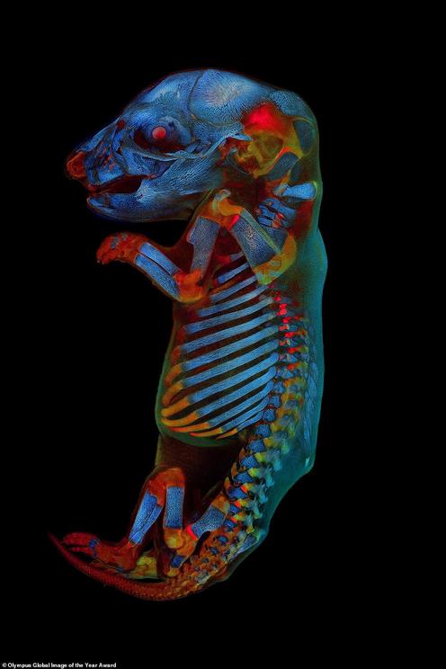 A rat fetus with red, devilish eyes and glowing tissue has been named winner of the second-ever Global Image of the Year Life Science Light Microscopy. Scientist Werner Zuschratter captured the embryo on its 21st day of development using a microscope that