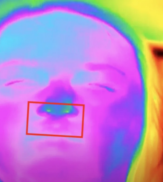 Thermal facial image of a hyperaroused driver.