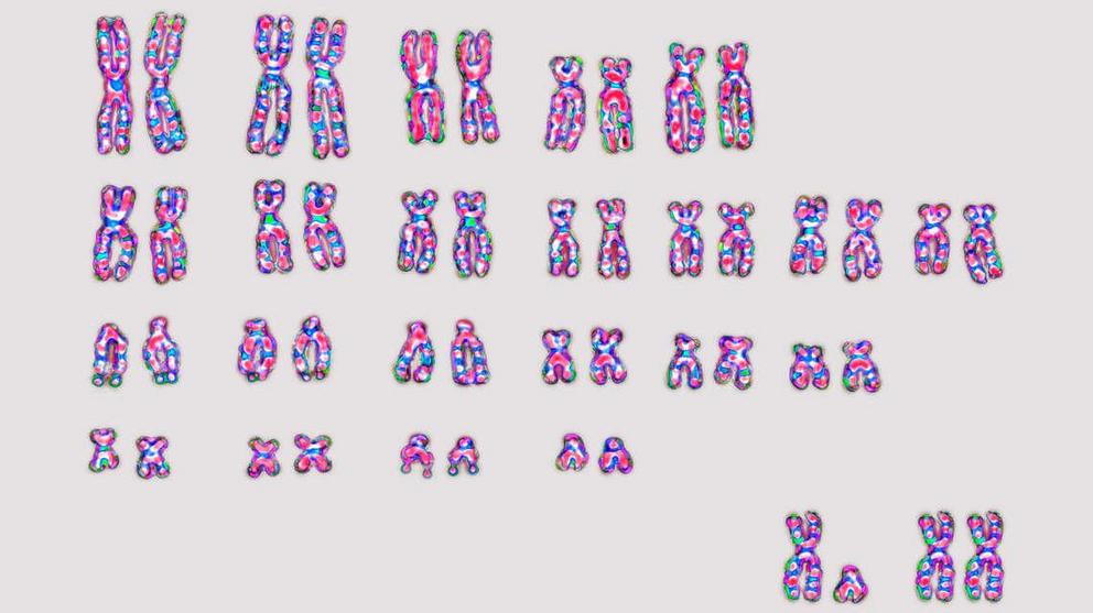 23 pairs of human chromosomes; the 23rd pair is either XX or XY (bottom). Credit: BSIP/Universal Images Group/Getty Images 