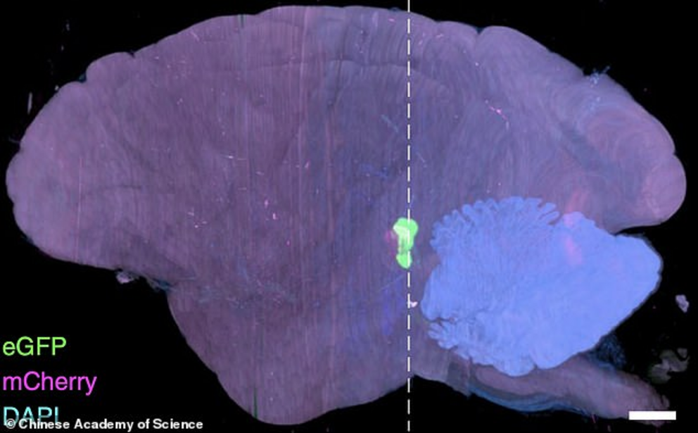 With billions of neurons captured in unprecedented detail, the team turned to artificial intelligence to study the results