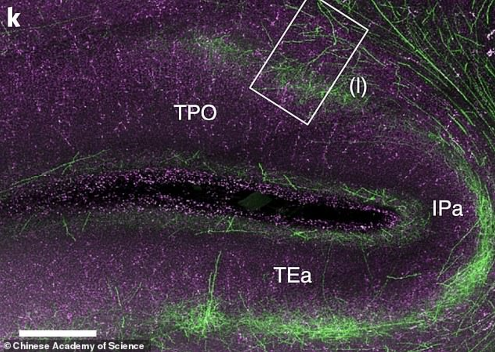 The new imagine technique allowed the team to map every neuron and fibre of the monkey brain in greater detail than previously possible