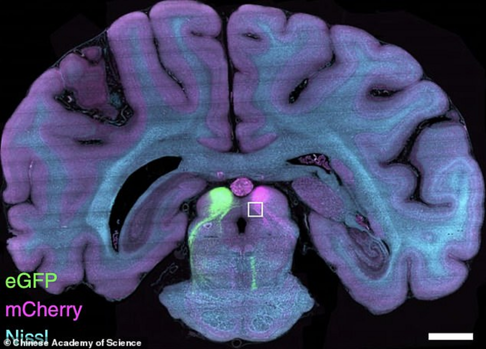 The team, including researchers from Zhejiang University, say that having such a detailed mapping of a primate brain will help in understand human diseases