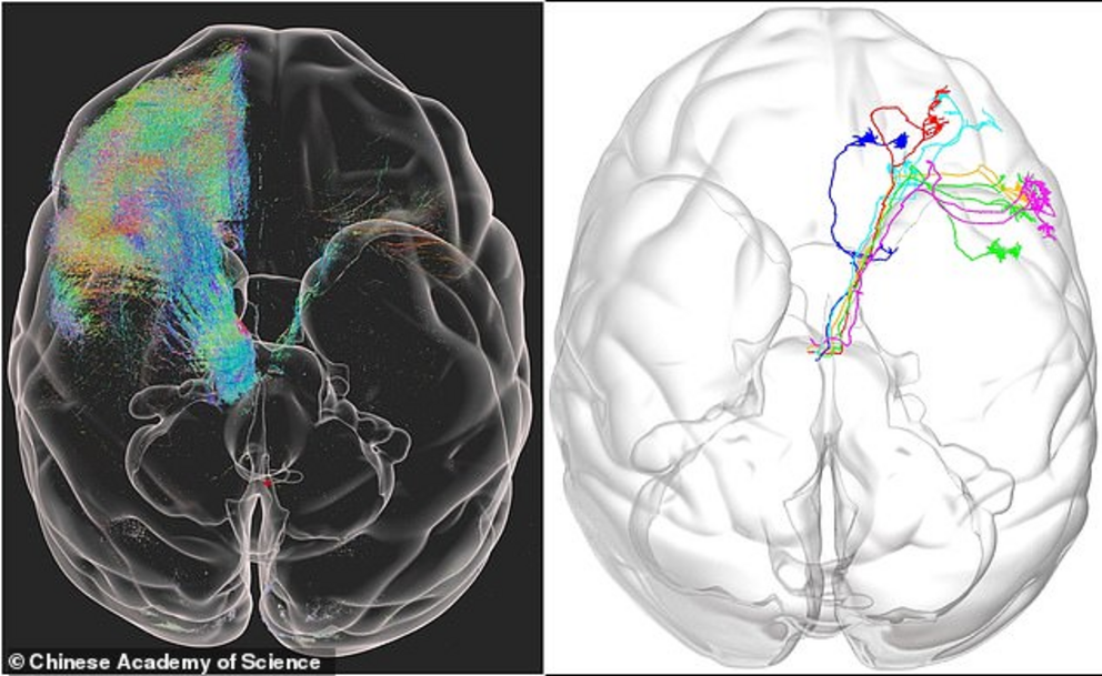 The world's first high-resolution 3D image of a monkey brain has been revealed in a breakthrough that could be used to treat human diseases including Parkinson's