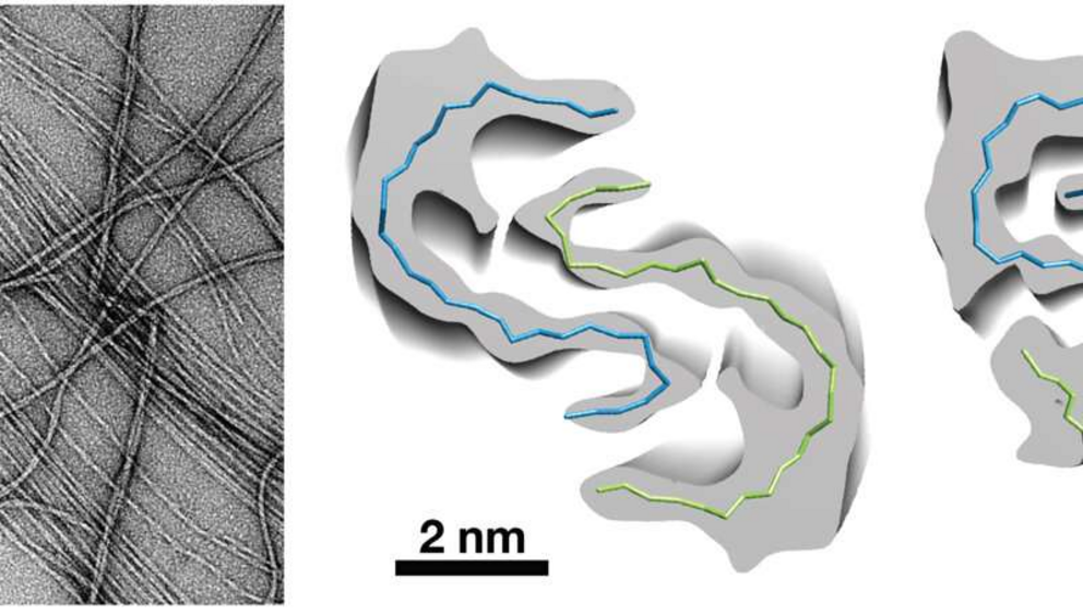 Electron microscopy and three-dimensional density reconstructions of amyloid fibrils resulting from the Uppsala APP mutation.