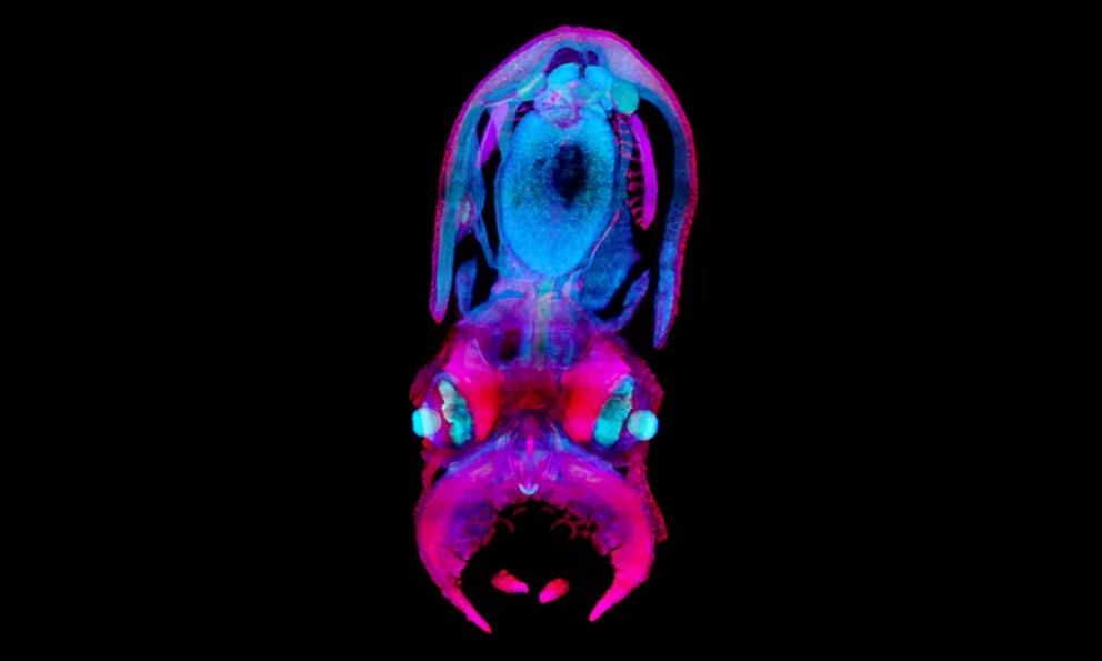 A 30-day-old octopus hatchling imaged using light-sheet microscopy.