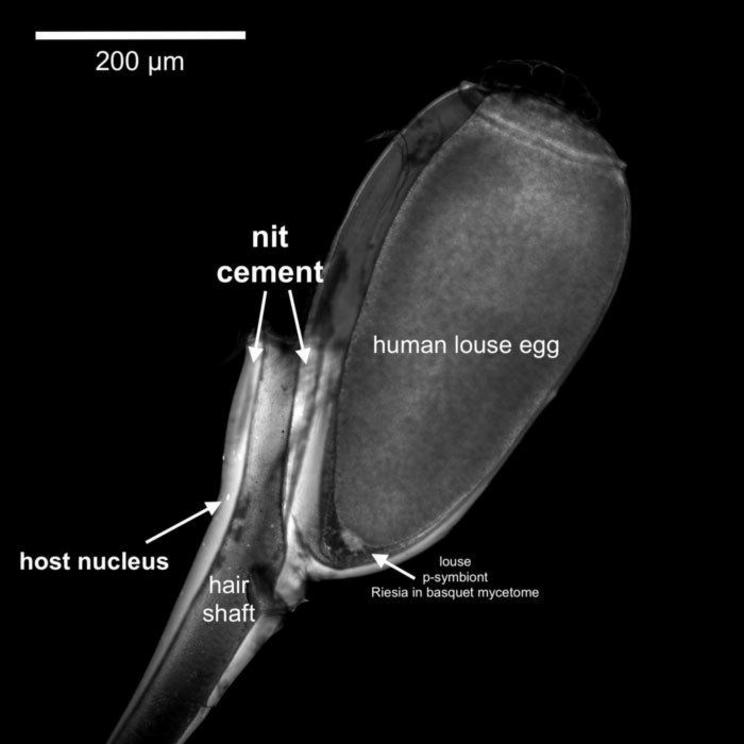 Human louse nit showing the cement covering the egg shell and hair shaft, including a human cell (nucleus, arrow).