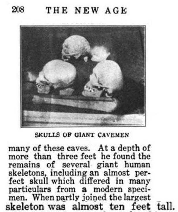 Skulls of giants with cranial deformation. 