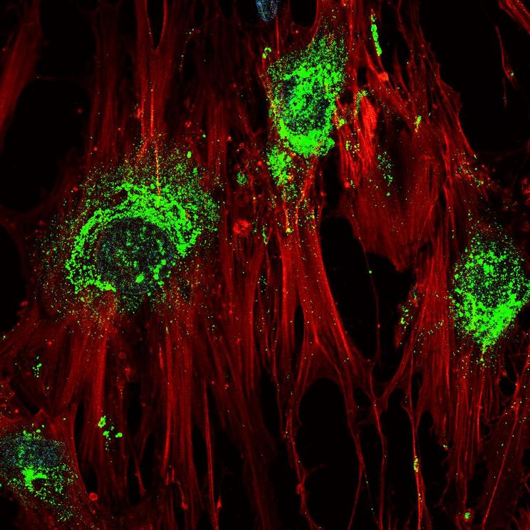 Magnified image showing adult stem cells in the process of turning into bone cells after treatment with high-frequency sound waves. Green colouring shows the presence of collagen, which the cells produce as they become bone cells. Magnification: 60X | Cre