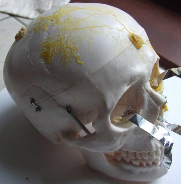 P. polycephalum growing on a life-sized model of a human skull.