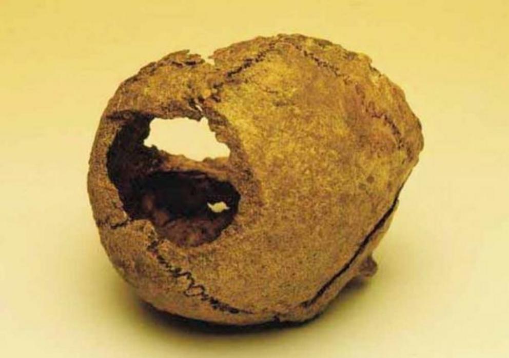 Woman’s Skull from Ballateare burial on the Isle of Man, believed to be the only clear example of a human sacrifice in the British Isles.