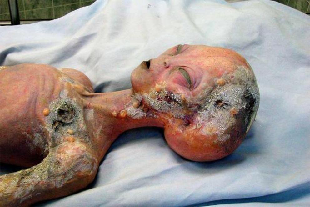 An alien autopsy, as depicted in the International UFO Museum and Research Center located in Roswell, New Mexico.