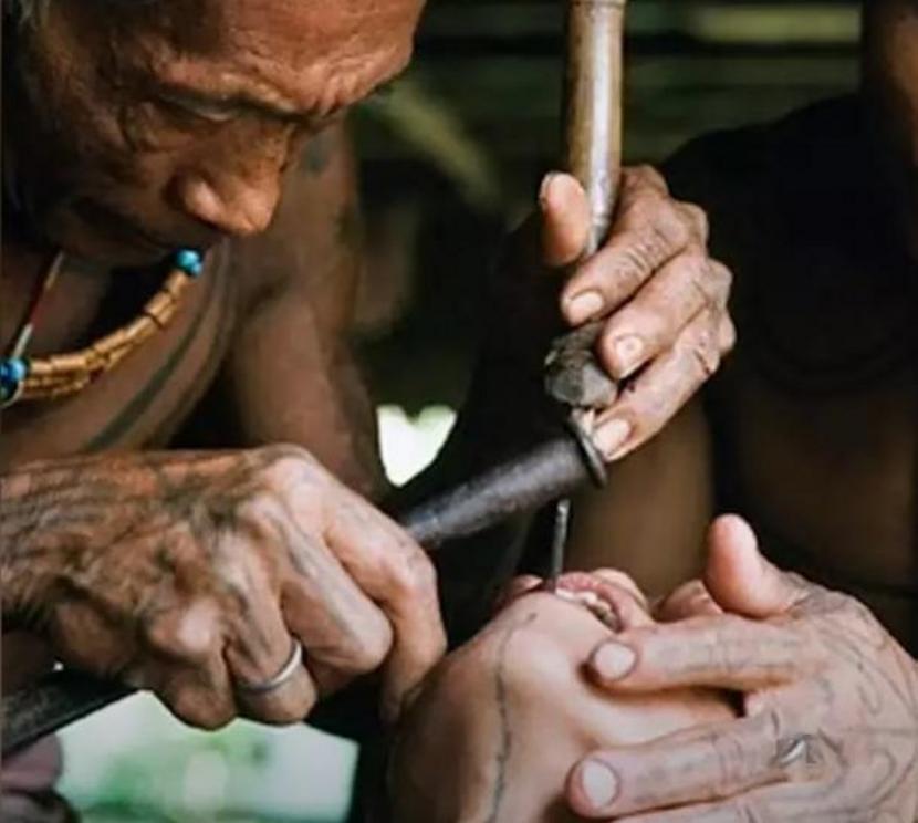 Maya dentists spun thin copper tubes in their hands which served as drills, with the abrasive quality coming from powdered quartz mixed in water.